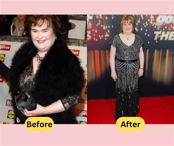 Susan Boyle underwent drastic weight loss to overcome her health problems